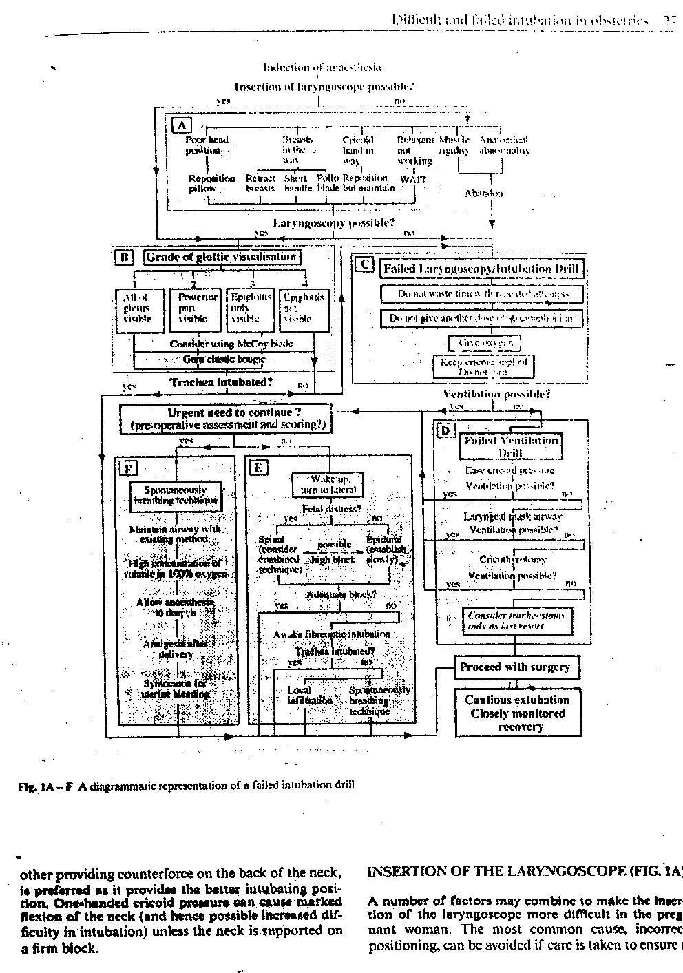 Obstetric Intubation - 3