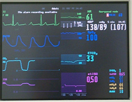 30-min Trend Displayed